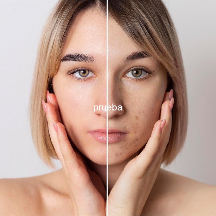 Foto 4 Limpieza facial con hidratación y exfoliación en Cambados