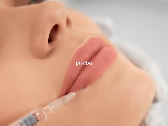 Tratamiento de fillers con ácido hialurónico